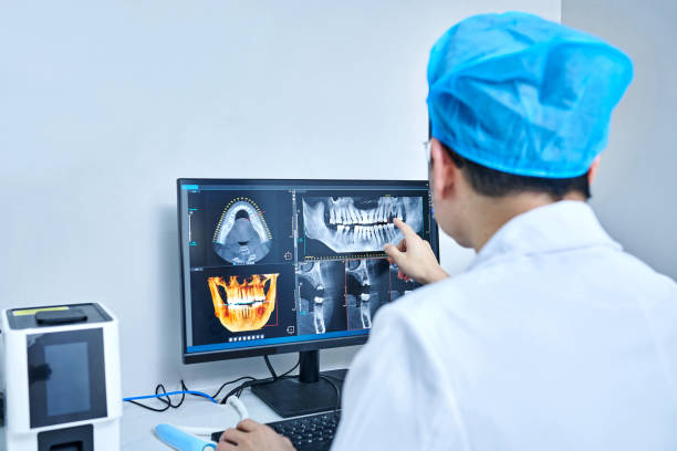 Best Emergency Dental Extractions in Nyon Lake, CA